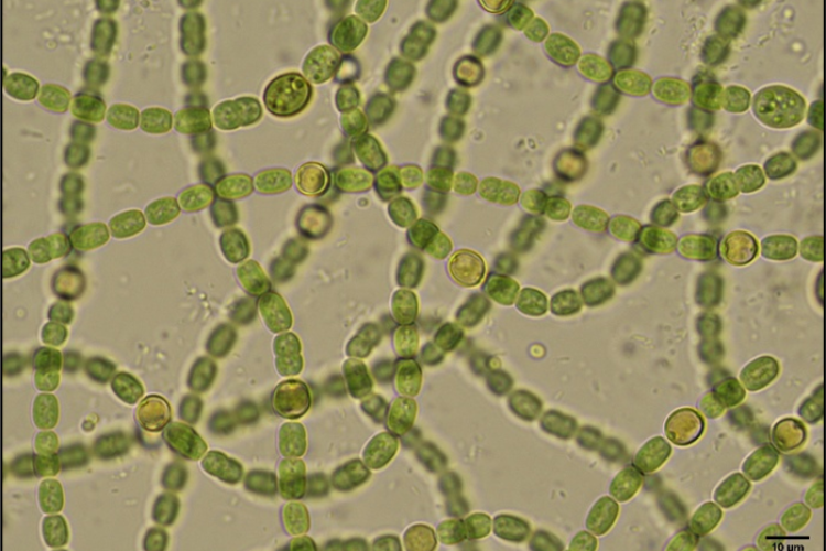 Nodularia. Immagine ottenute al microscopio ottico (100x).