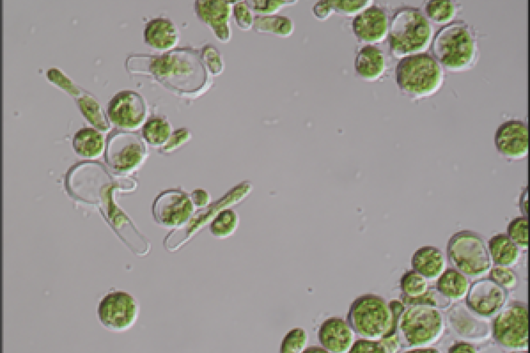 Pseudodendoclonium printzii. Immagine ottenute al microscopio ottico (100x).